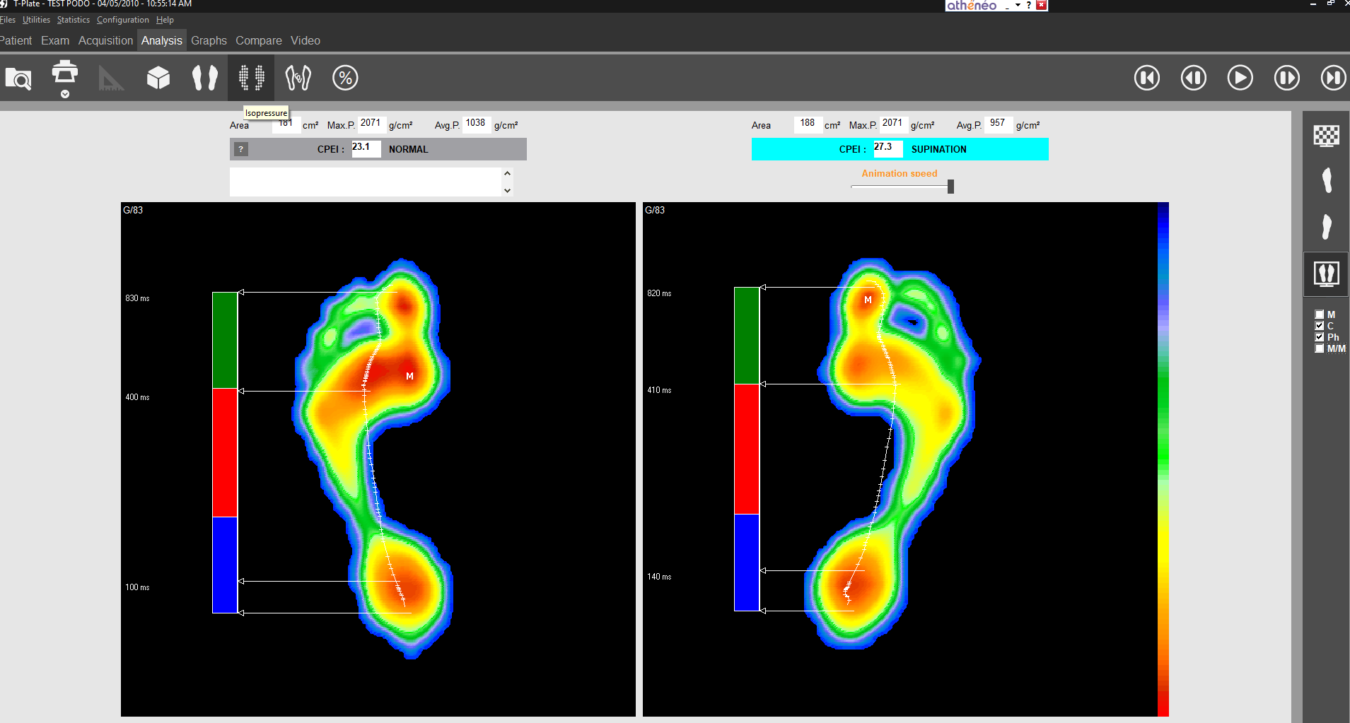 T-PLATE foot pressure plate - Medicapteurs - Podologie, Posturologie et ...